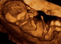 Echographie 3D foetus 3ème mois grossesse