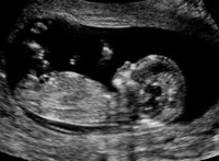 1ère échographie foetus