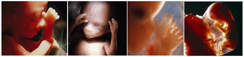 Foetus à la 16ème semaine de grossesse - 18ème semaine d'aménorrhée