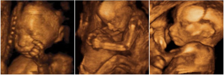 Semaine 22 grossesse : Evolution et développement du foetus