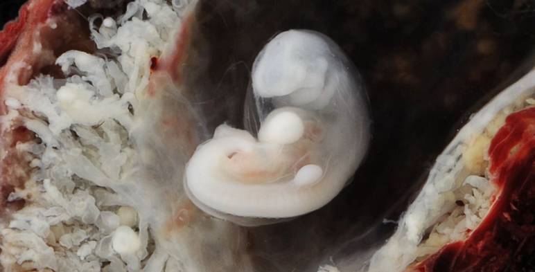 Embryologie : 3 semaines de grossesse