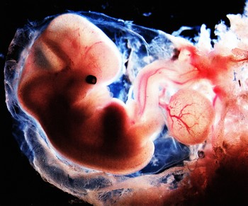 Embryon à la 6ème semaine de grossesse