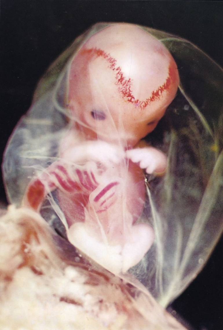 8ème semaine de grossesse : Embryon 
