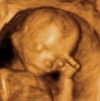 Grossesse mois par mois - Foetus 3ème mois 