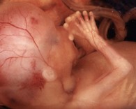 Evolution foetus - 17ème semaine grossesse