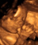 Echographie du foetus qui prend son pouce