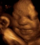 Echographie du foetus de 26 semaines