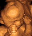 Foetus de 26 semaines de grossesse
