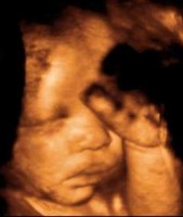Echographie à 27 semaines de grossesse