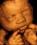 Foetus de 28 semaines