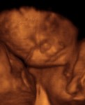Bébé à 28 semaines de grossesse