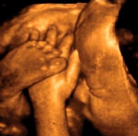 Foetus à 32 semaines de grossesse : bébé est vraiment à l'étroit maintenant !