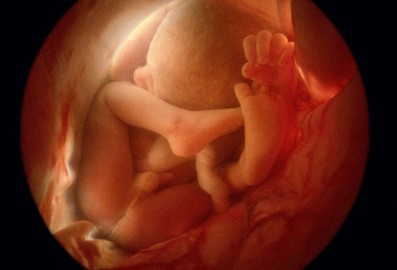 Le foetus à 36 semaines de grossesse : il est à l'étroit !