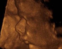 Foetus de profil - 9ème mois