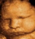 Foetus de face