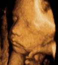 Foetus de profil