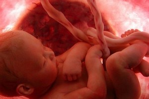 Foetus à 34 semaines de grossesse