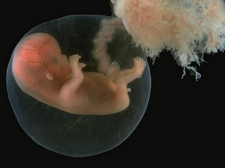 Développement du foetus à 9 semaines de grossesse