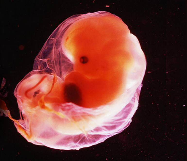 Embryon à 5 semaines de grossesse