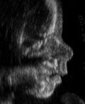 Profil du foetus à 7 mois de grossesse