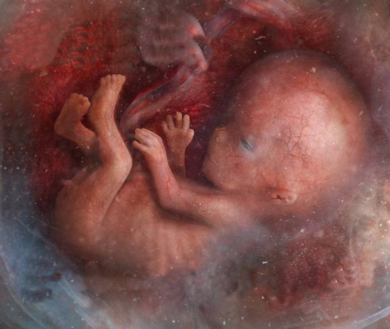 Foetus à la 9ème semaine de grossesse