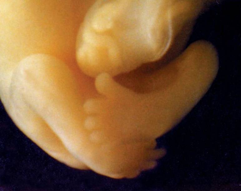 Jambes et pieds du bébé à 9 semaines de grossesse