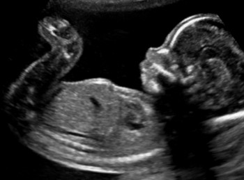 concept de test d'échographie pour bébé enceinte. jeune couple heureux  attendant bébé debout et regardant l'échographie faite par une femme  médecin en clinique se sentant excité illustration vectorielle 13489052 Art  vectoriel chez
