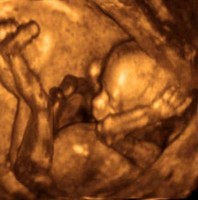 Echographie du foetus 4ème mois de grossesse