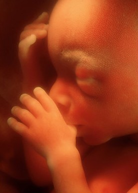 Foetus 19ème semaine de grossesse