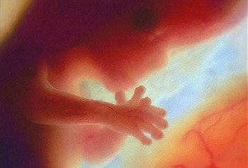 Foetus 3ème mois de grossesse