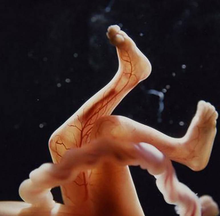 Les jambes et les pieds du foetus à 10 semaines de grossesse
